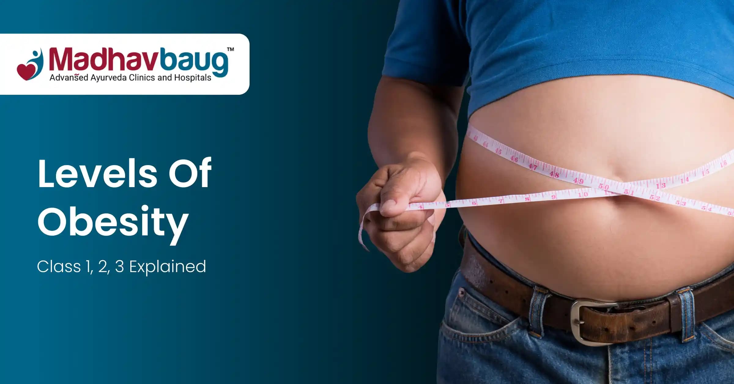 Levels of Obesity: Class 1, 2, and 3 Explained