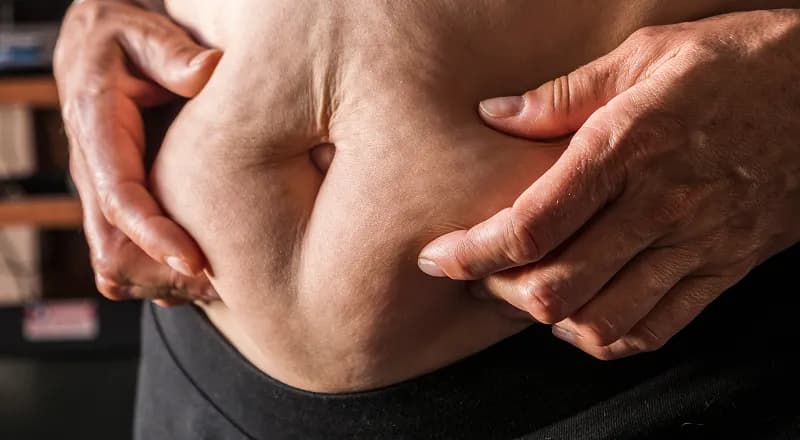 Metabolic dysfunction
