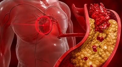Uncontrolled blood pressure