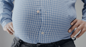 Obesity