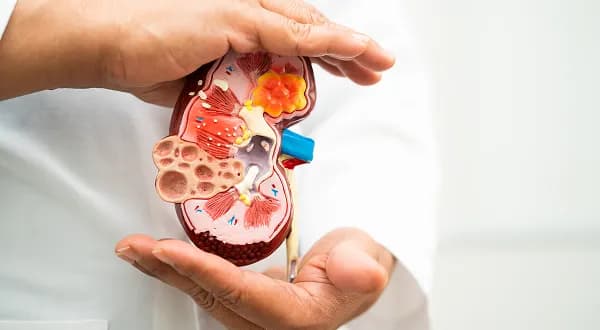 Kidney Disease