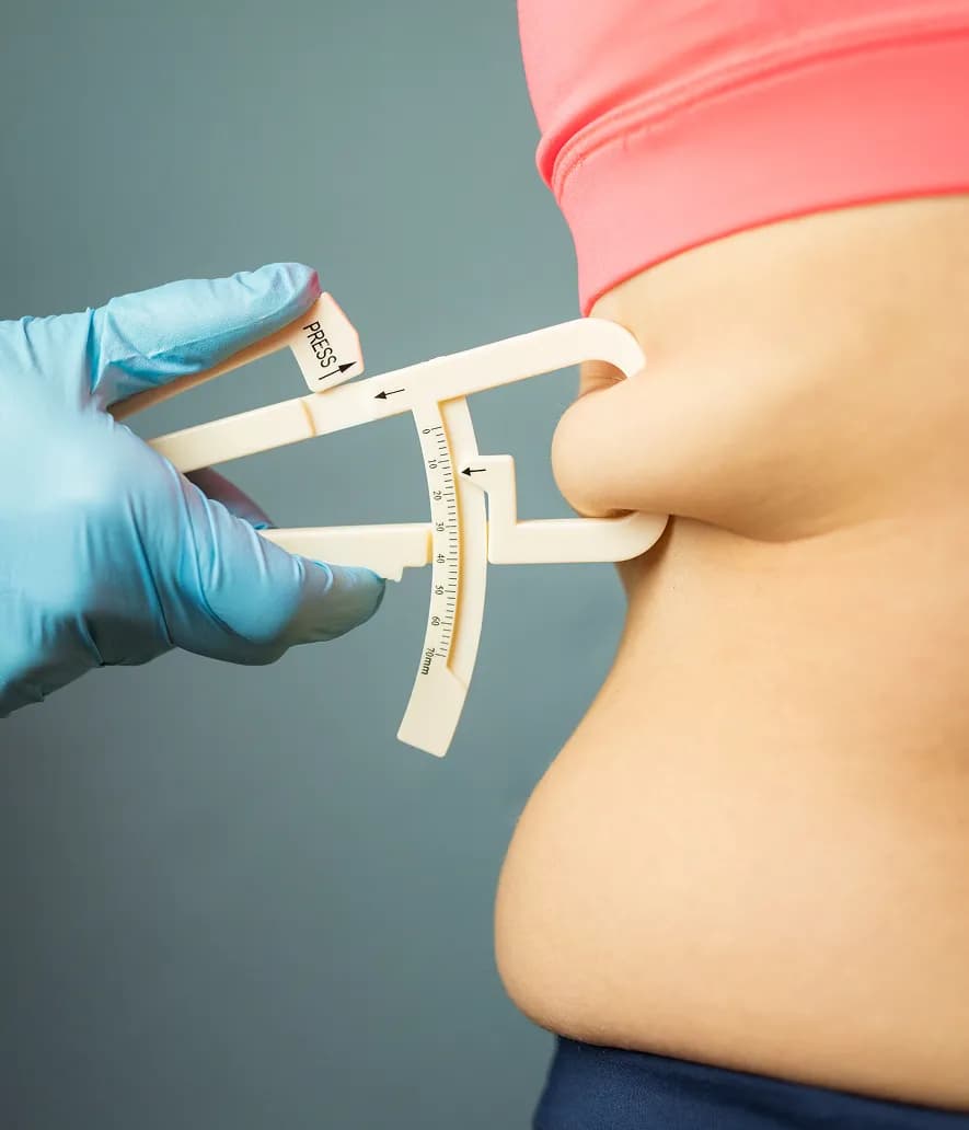 How Is Excess Weight Diagnosed?