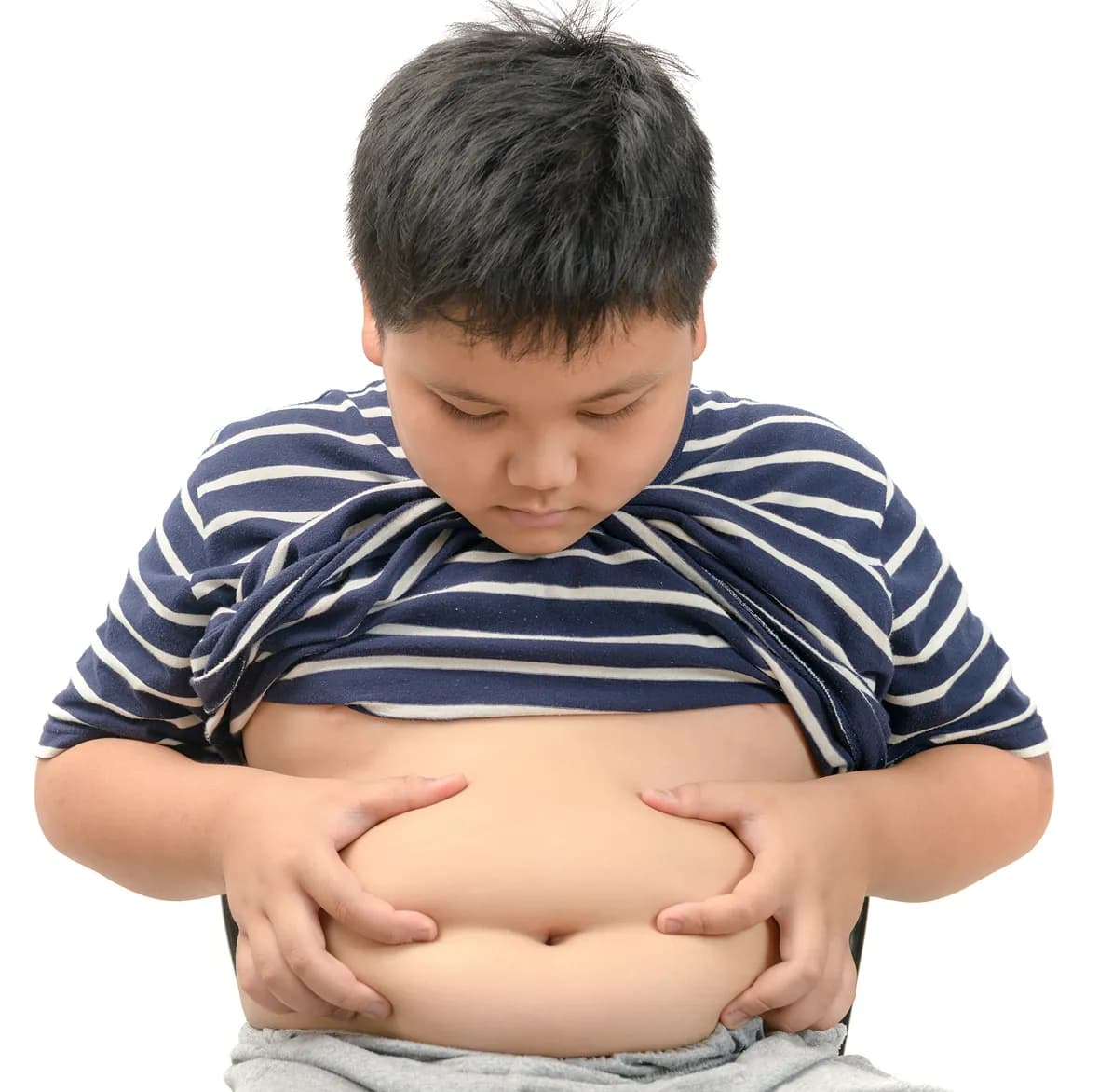 What is Childhood Obesity?