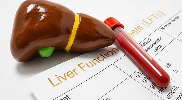 Liver Function Test (LFT)