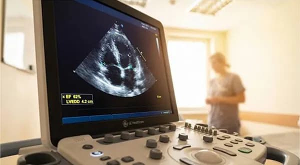 Ejection Fraction