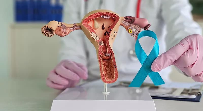 Endometrial Cancer 