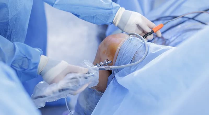 Joint Replacement Surgery