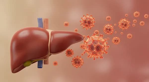 Non-Alcoholic Fatty Liver Disease 