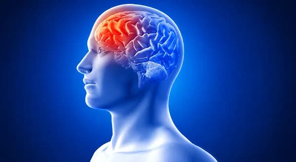 Brain Stroke