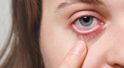 Diabetic Retinopathy