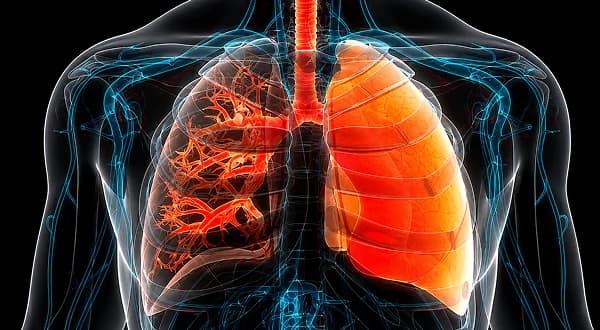 Pulmonary hypertension