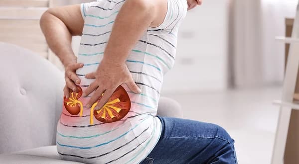 Kidney Failure