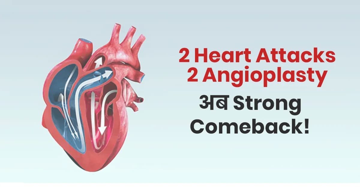 2 Angioplasty Recovery of Diwakar Nene — एक Real Heart Reversal Success Story