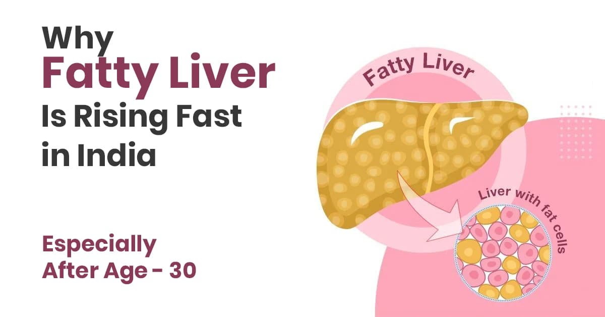 Why Fatty Liver Is Rising Fast in India — Especially After Age 30