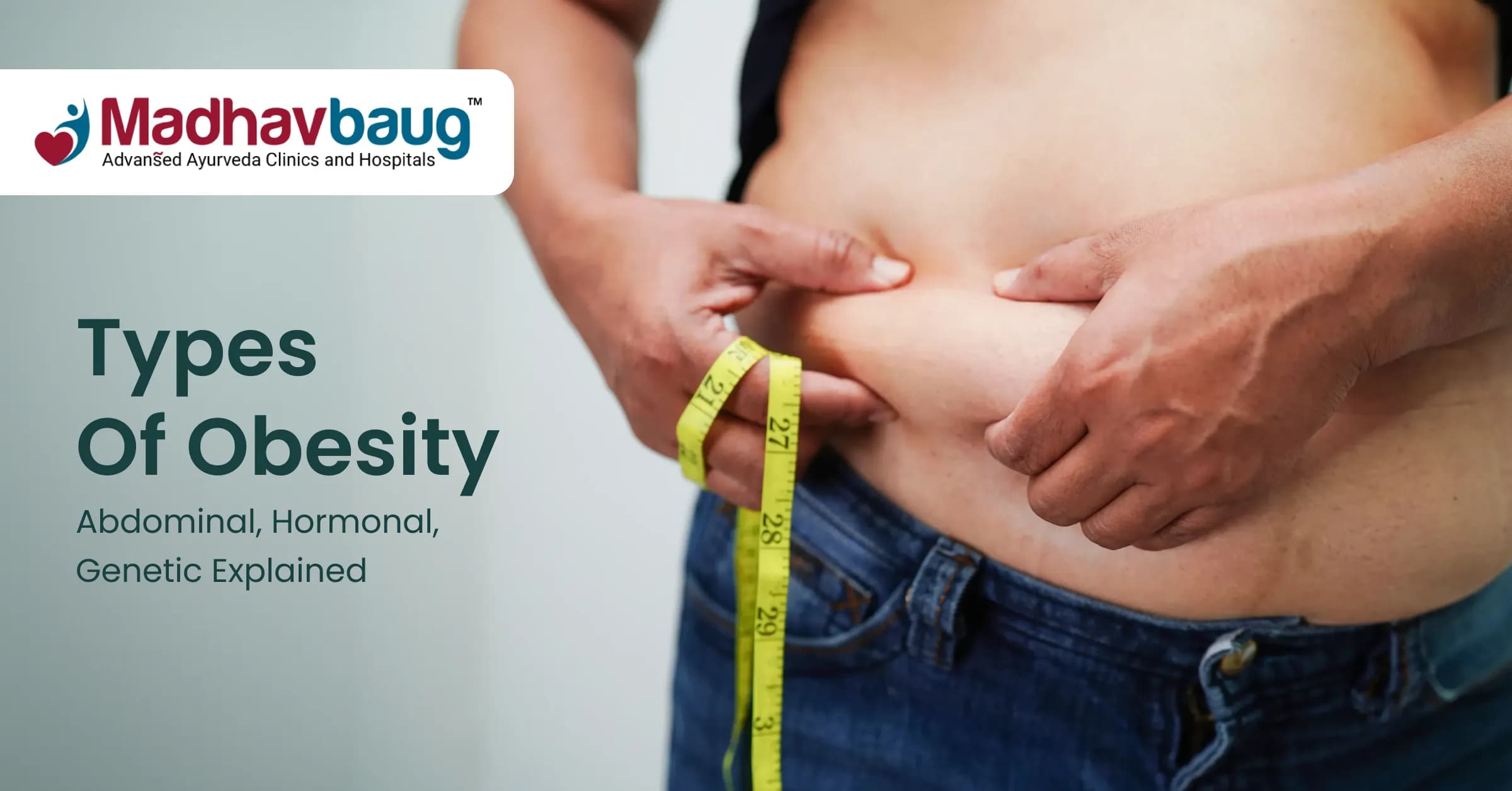 Types of Obesity: Abdominal, Hormonal, and Genetic Explained
