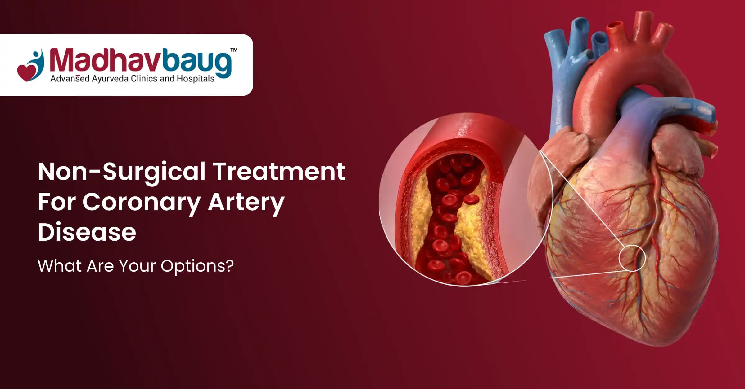 Non-Surgical Treatment for Coronary Artery Disease: What Are Your Options?