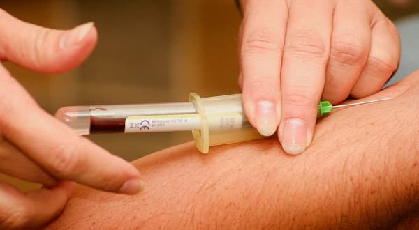 Serum Insulin Test