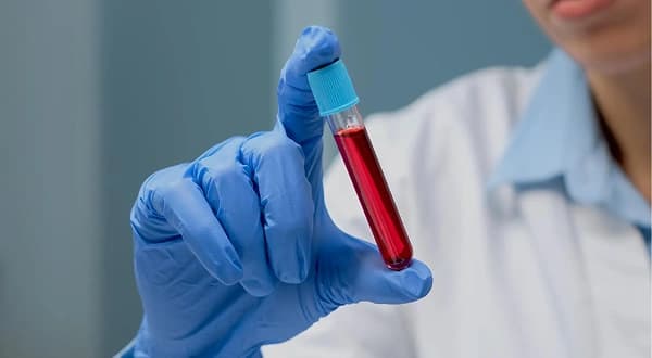 C-Peptide Test