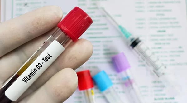 Vitamin D3 Test