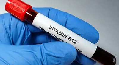 Vitamin B12 Test