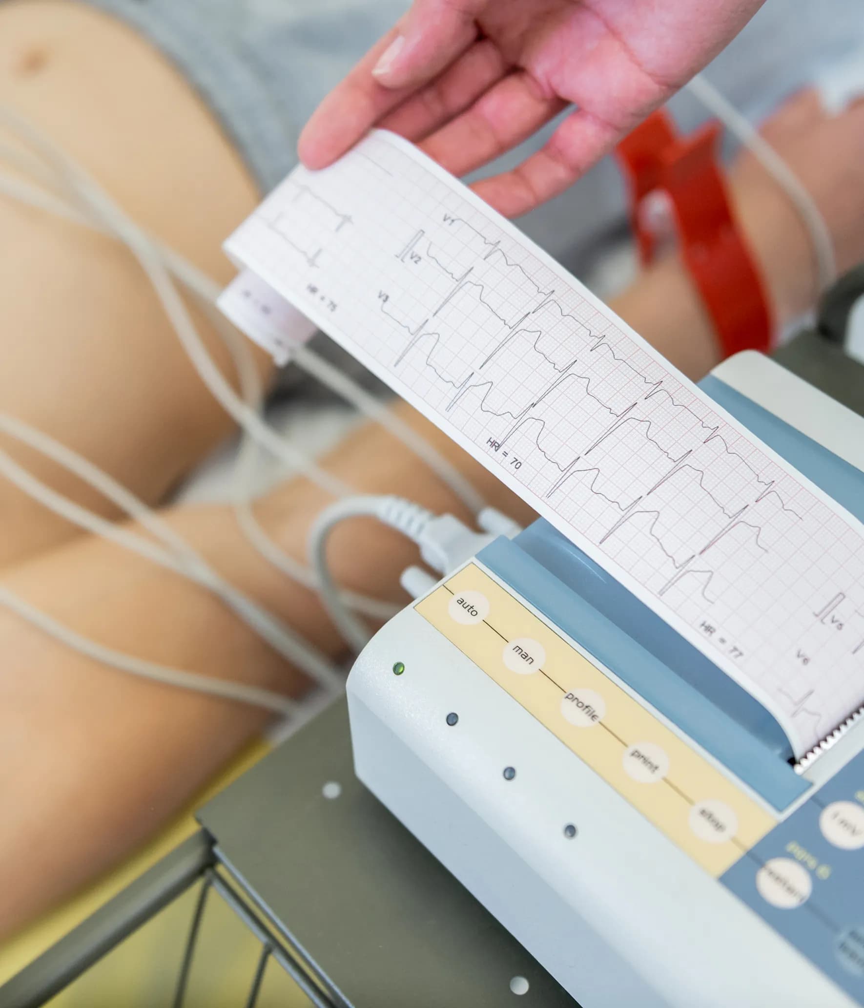 How to Diagnose Prediabetes?