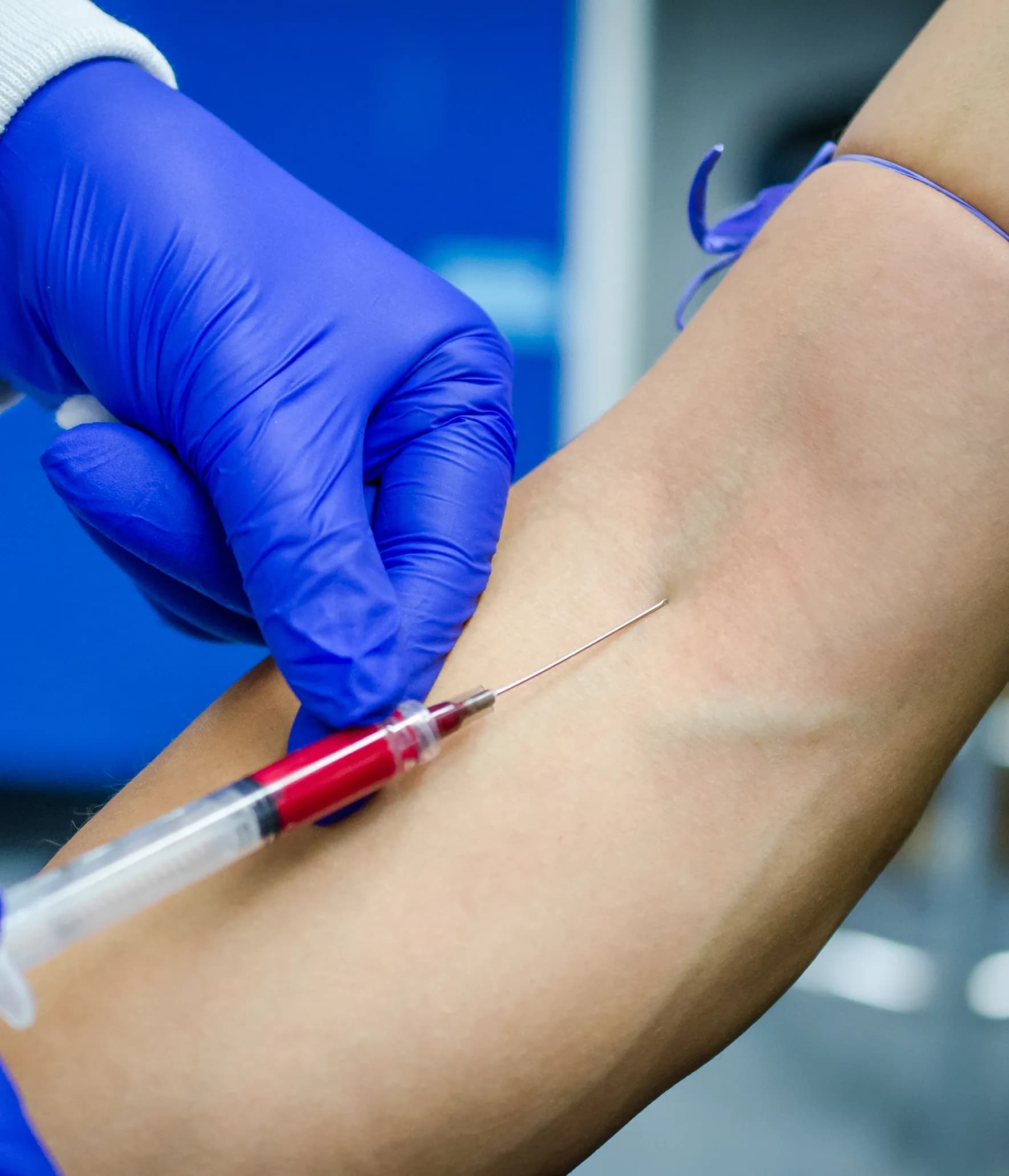 How Is Insulin Resistance Diagnosed?