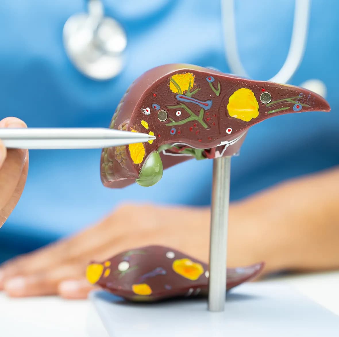 What are Diabetes and Fatty Liver Disease?