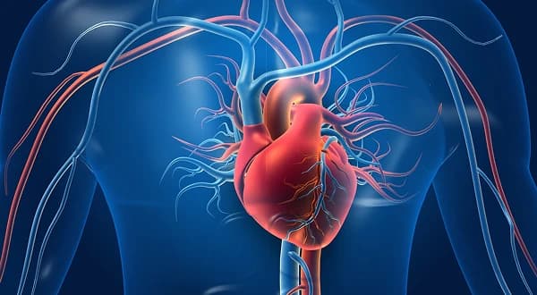 Coronary artery disease