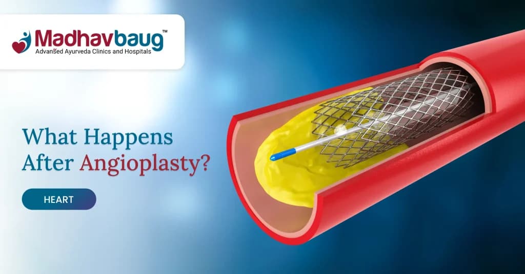 Ayurveda After Angioplasty: What Supportive Care Can Do