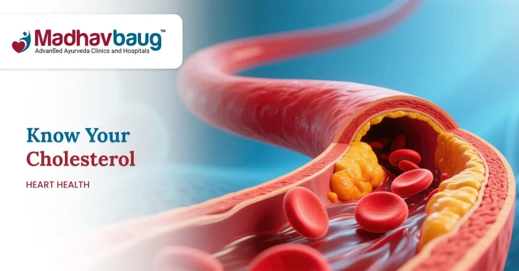 What Is a Lipid Profile Test? Understanding Your Cholesterol Report