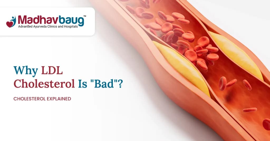 What Is LDL Cholesterol and Why Is It Called Bad Cholesterol?