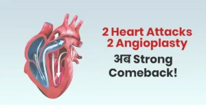 2 angioplasty recovery