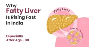 fatty liver disease after 30 in india